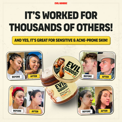 Bálsamo de sebo todo en uno: combate el acné, suaviza las arrugas y mantiene la piel suave todo el día.